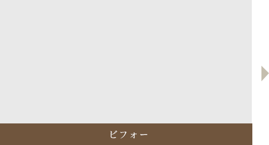 ビフォー